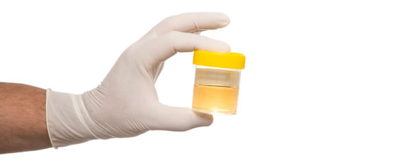 urine-collection